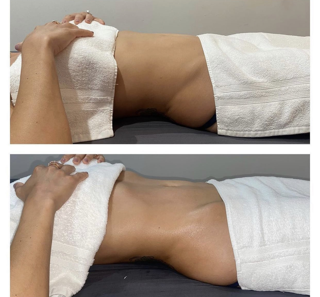 Post-Surgical Lymphatic Drainage Massage in Atlanta, GA