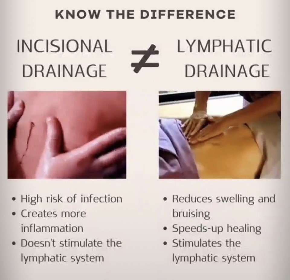 A poster about the difference between incisional drainage and lymphatic drainage